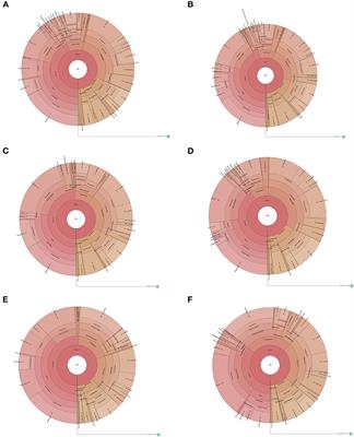 Compare the Effect of Inhaled Corticosteroids and Systemic Corticosteroids on Sputum Microbiome of AECOPD